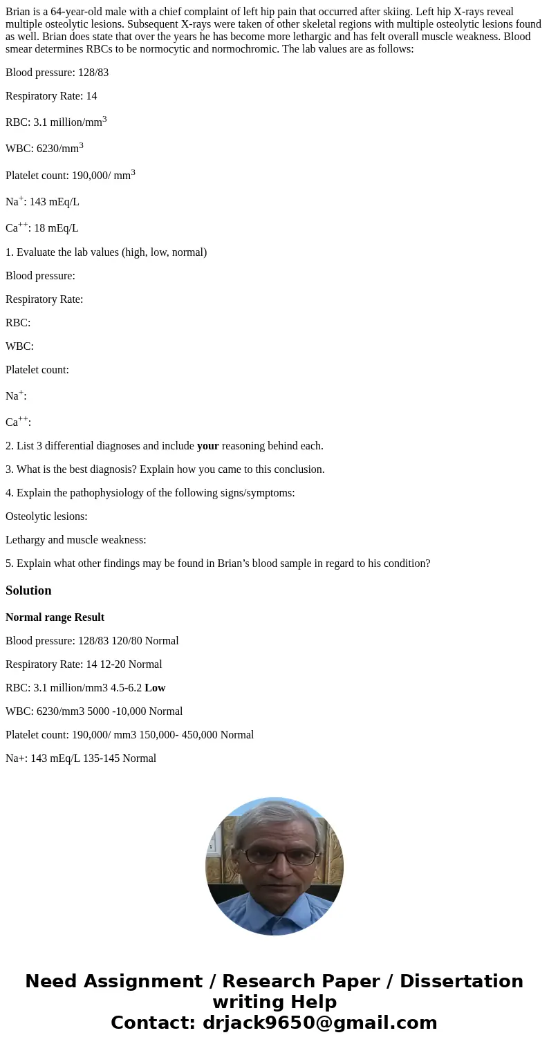 Brian is a 64-year-old male with a chief complaint of left hip pain that occurred after skiing. Left hip X-rays reveal multiple osteolytic lesions. Subsequent X