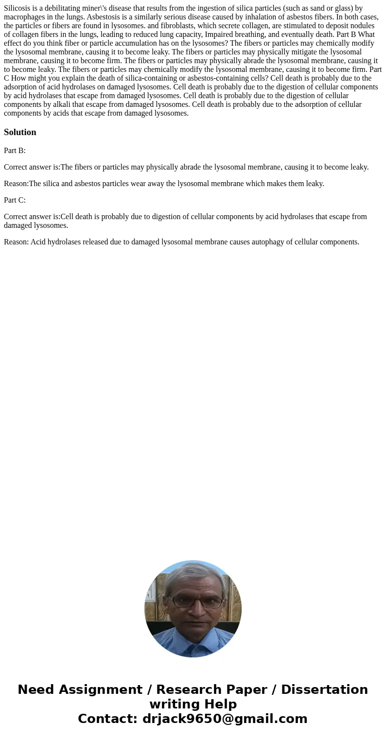  Silicosis is a debilitating miner\'s disease that results from the ingestion of silica particles (such as sand or glass) by macrophages in the lungs. Asbestosi