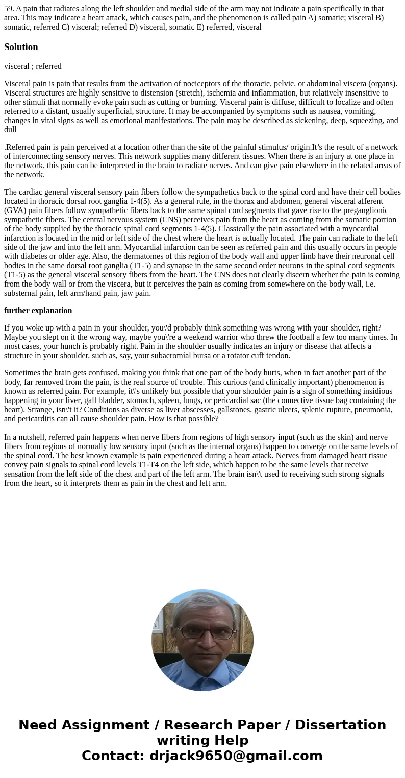 59. A pain that radiates along the left shoulder and medial side of the arm may not indicate a pain specifically in that area. This may indicate a heart attack  59. A pain that radiates along the left shoulder and medial side of the arm may not indicate a pain specifically in that area. This may indicate a heart attack