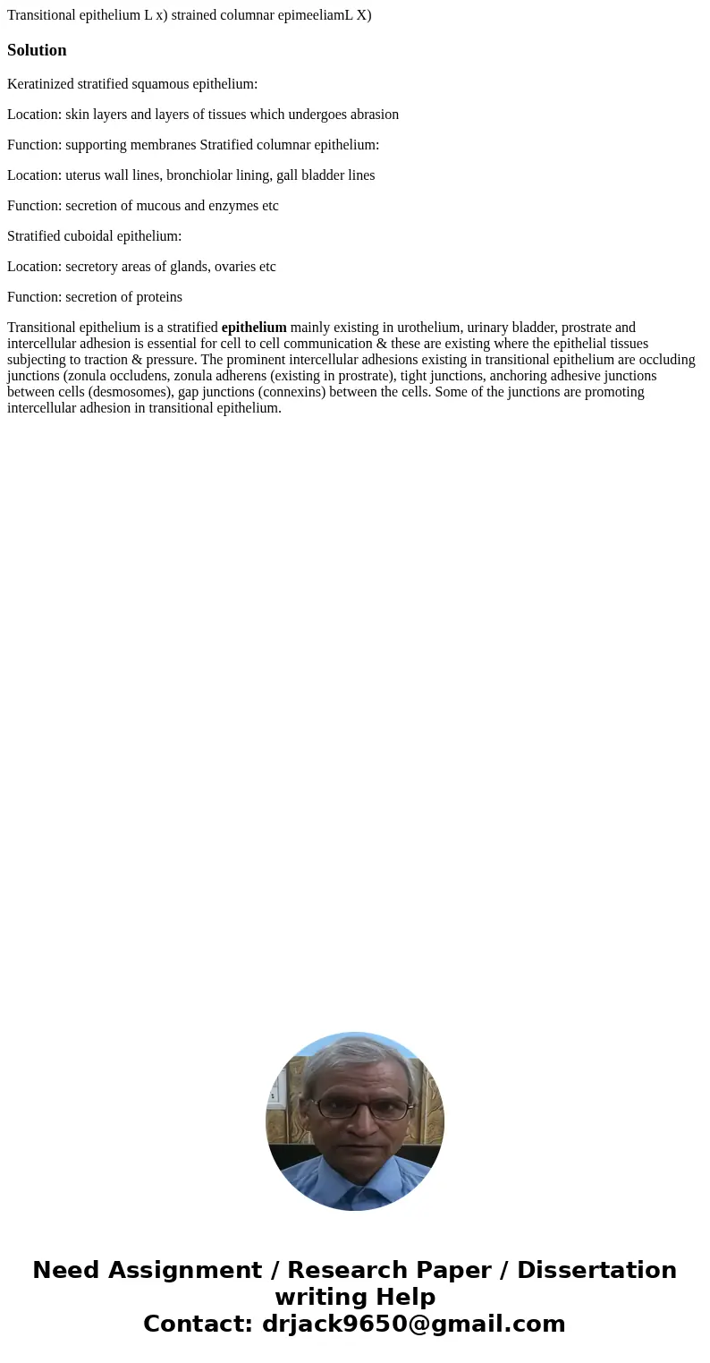  Transitional epithelium L x) strained columnar epimeeliamL X) SolutionKeratinized stratified squamous epithelium: Location: skin layers and layers of tissues w