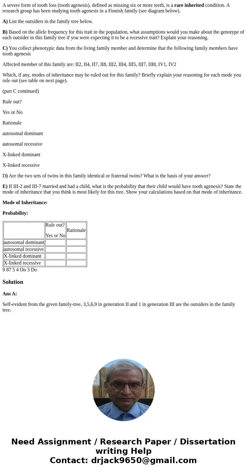 A severe form of tooth loss (tooth agenesis), defined as missing six or more teeth, is a rare inherited condition. A research group has been studying tooth agen A severe form of tooth loss (tooth agenesis), defined as missing six or more teeth, is a rare inherited condition. A research group has been studying tooth agen