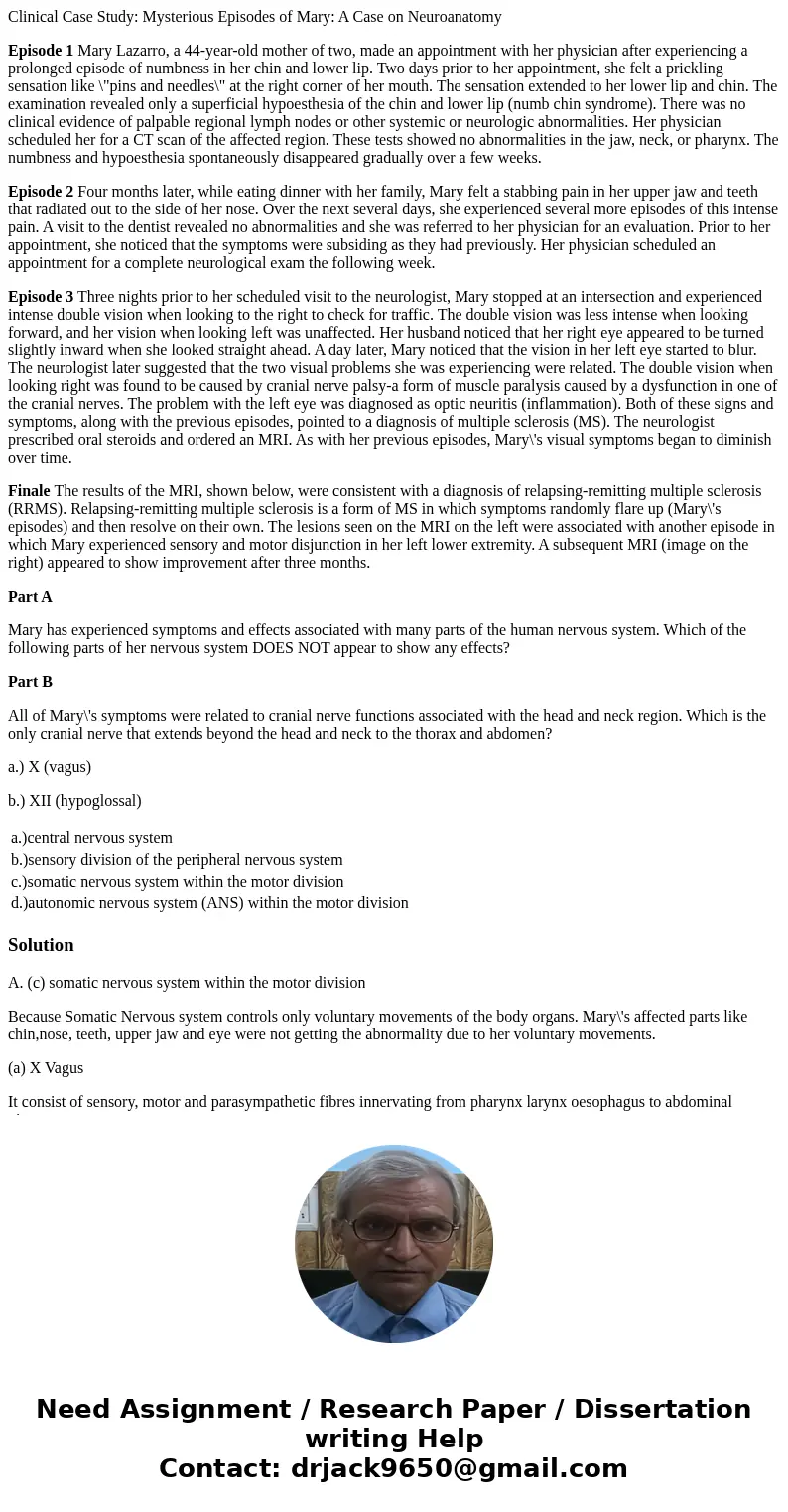 Clinical Case Study: Mysterious Episodes of Mary: A Case on Neuroanatomy Episode 1 Mary Lazarro, a 44-year-old mother of two, made an appointment with her physi
