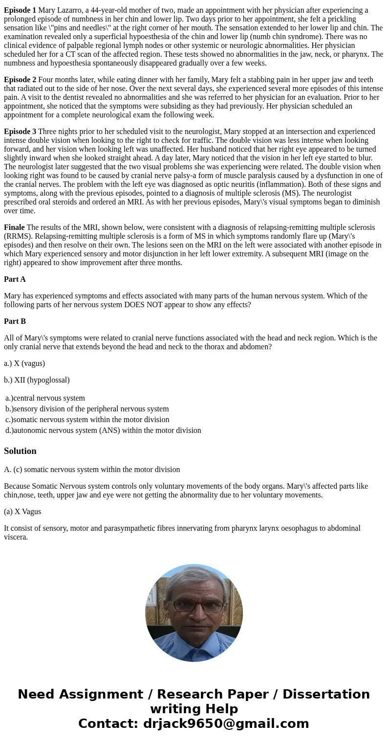 Clinical Case Study: Mysterious Episodes of Mary: A Case on Neuroanatomy Episode 1 Mary Lazarro, a 44-year-old mother of two, made an appointment with her physi