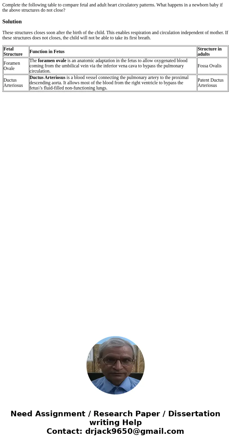  Complete the following table to compare fetal and adult heart circulatory patterns. What happens in a newborn baby if the above structures do not close? Soluti