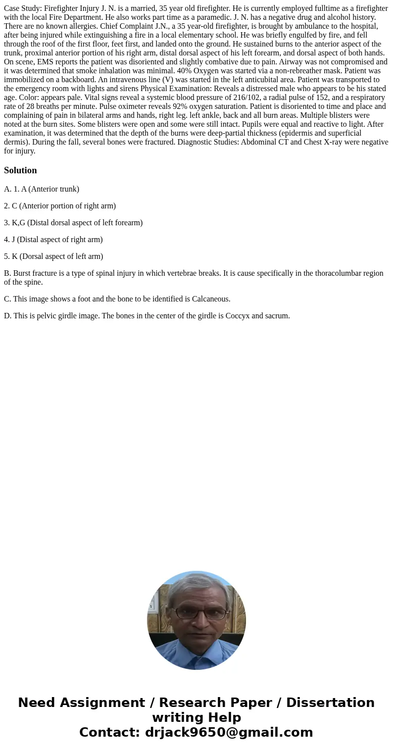  Case Study: Firefighter Injury J. N. is a married, 35 year old firefighter. He is currently employed fulltime as a firefighter with the local Fire Department. 
