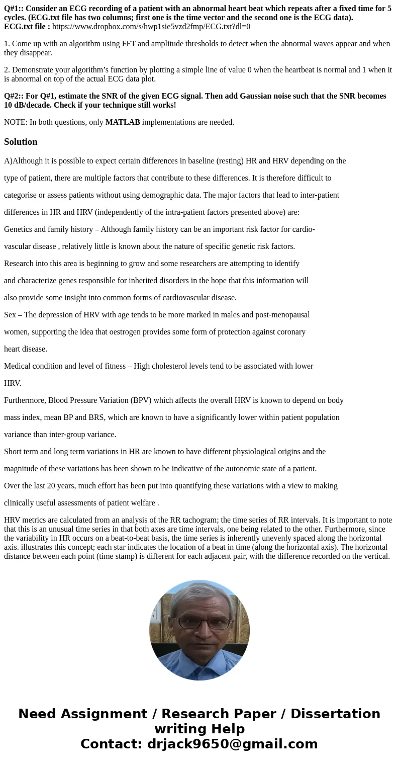 Q#1:: Consider an ECG recording of a patient with an abnormal heart beat which repeats after a fixed time for 5 cycles. (ECG.txt file has two columns; first one Q#1:: Consider an ECG recording of a patient with an abnormal heart beat which repeats after a fixed time for 5 cycles. (ECG.txt file has two columns; first one