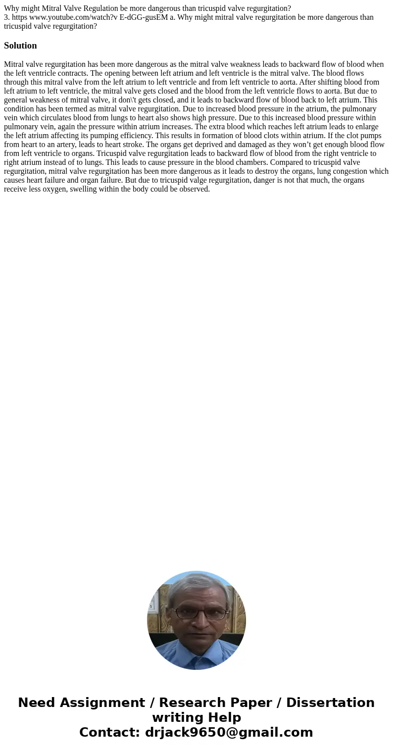 Why might Mitral Valve Regulation be more dangerous than tricuspid valve regurgitation? 3. https www.youtube.com/watch?v E-dGG-gusEM a. Why might mitral valve r Why might Mitral Valve Regulation be more dangerous than tricuspid valve regurgitation? 3. https www.youtube.com/watch?v E-dGG-gusEM a. Why might mitral valve r