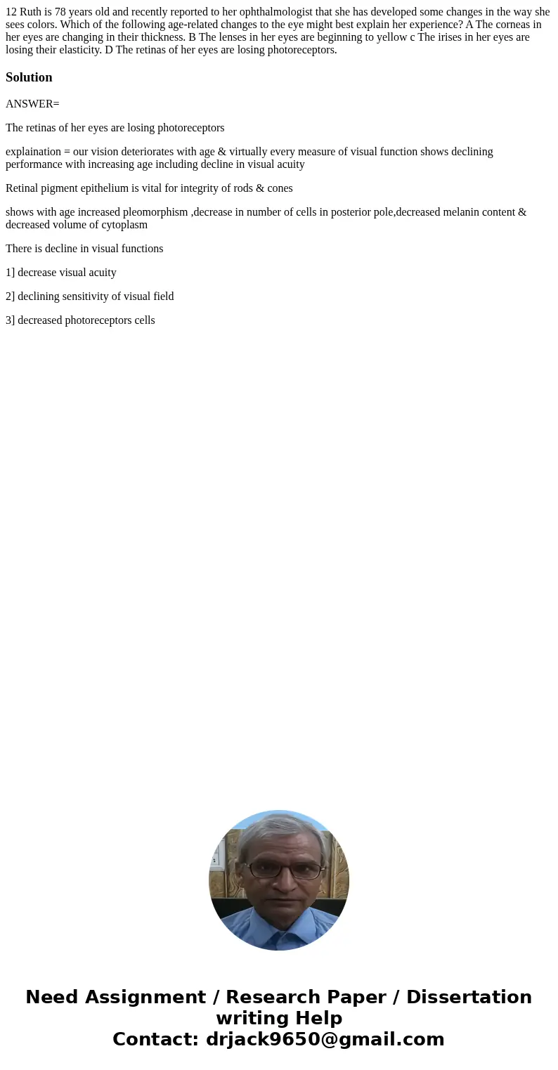 12 Ruth is 78 years old and recently reported to her ophthalmologist that she has developed some changes in the way she sees colors. Which of the following age  12 Ruth is 78 years old and recently reported to her ophthalmologist that she has developed some changes in the way she sees colors. Which of the following age