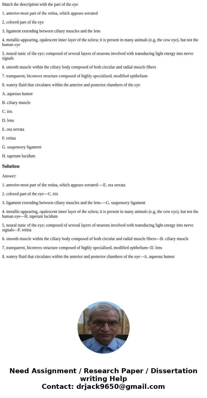 Match the description with the part of the eye 1. anterior-most part of the retina, which appears serrated 2. colored part of the eye 3. ligament extending betw