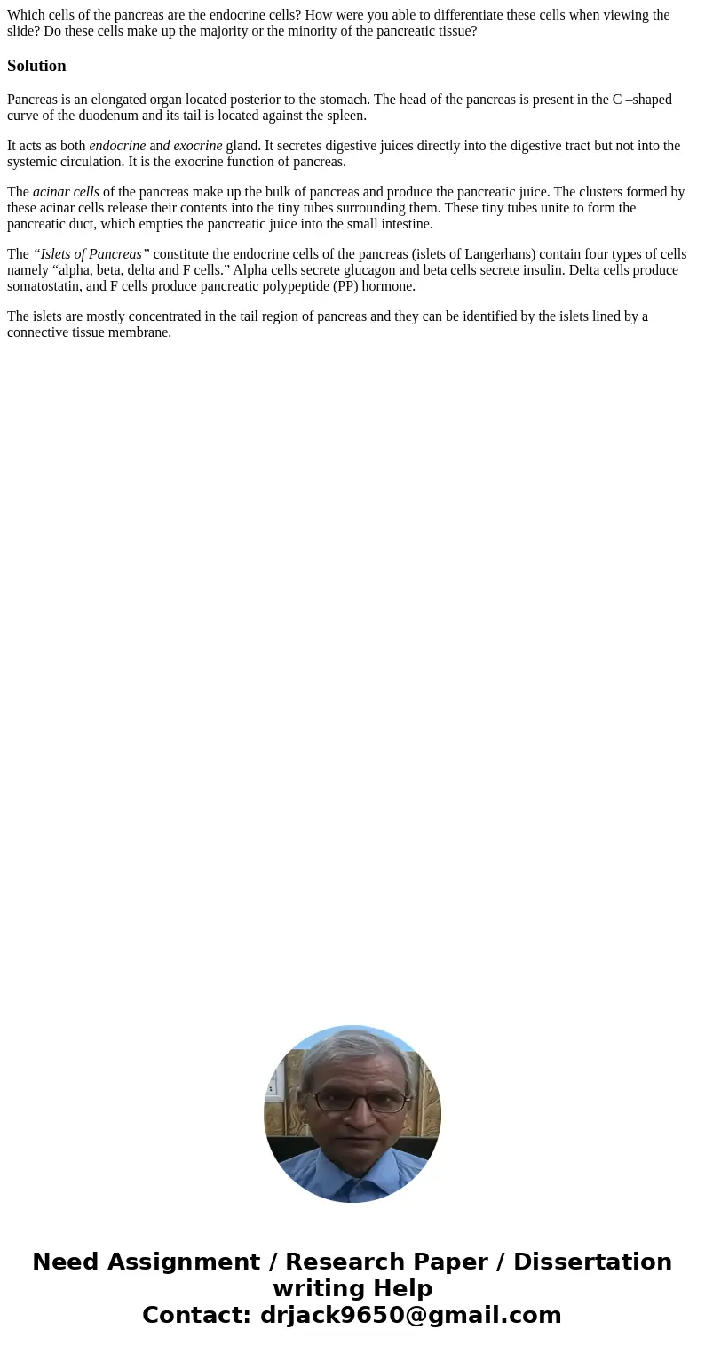 Which cells of the pancreas are the endocrine cells? How were you able to differentiate these cells when viewing the slide? Do these cells make up the majority  Which cells of the pancreas are the endocrine cells? How were you able to differentiate these cells when viewing the slide? Do these cells make up the majority