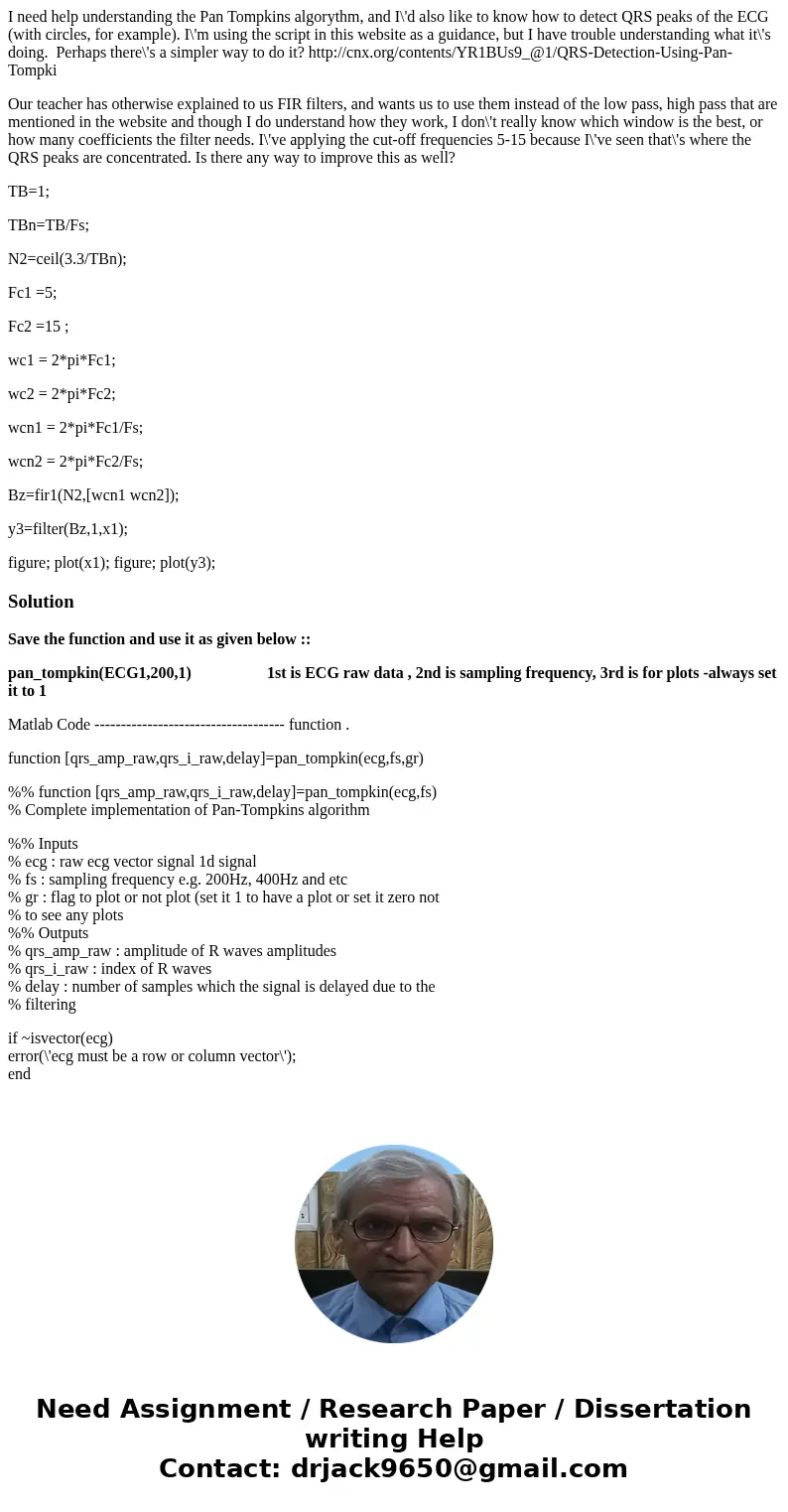 I need help understanding the Pan Tompkins algorythm, and I\'d also like to know how to detect QRS peaks of the ECG (with circles, for example). I\'m using the  I need help understanding the Pan Tompkins algorythm, and I\'d also like to know how to detect QRS peaks of the ECG (with circles, for example). I\'m using the