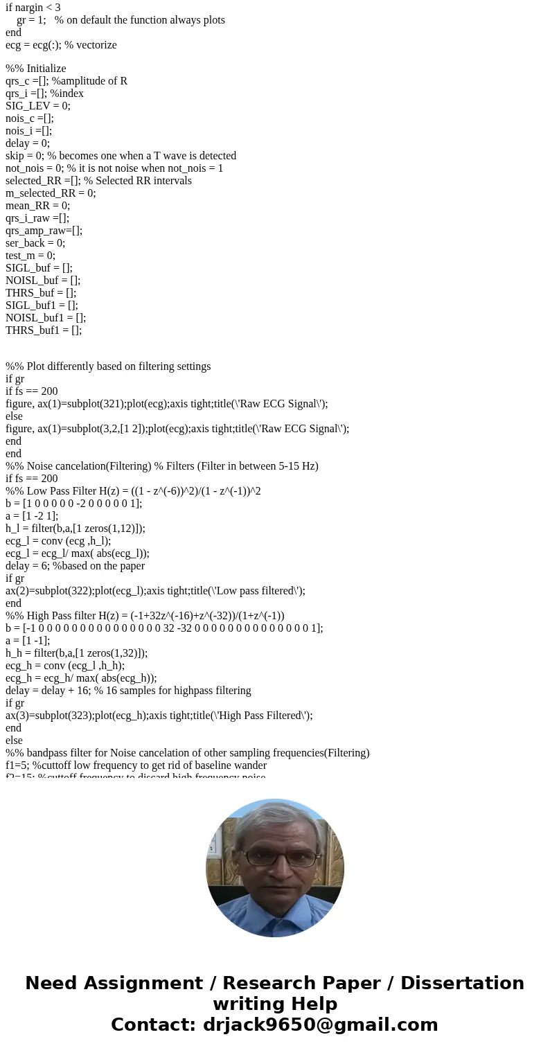 I need help understanding the Pan Tompkins algorythm, and I\'d also like to know how to detect QRS peaks of the ECG (with circles, for example). I\'m using the  I need help understanding the Pan Tompkins algorythm, and I\'d also like to know how to detect QRS peaks of the ECG (with circles, for example). I\'m using the