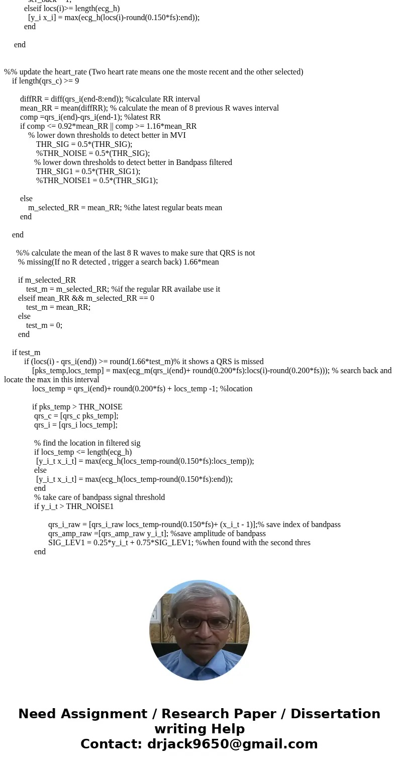 I need help understanding the Pan Tompkins algorythm, and I\'d also like to know how to detect QRS peaks of the ECG (with circles, for example). I\'m using the  I need help understanding the Pan Tompkins algorythm, and I\'d also like to know how to detect QRS peaks of the ECG (with circles, for example). I\'m using the