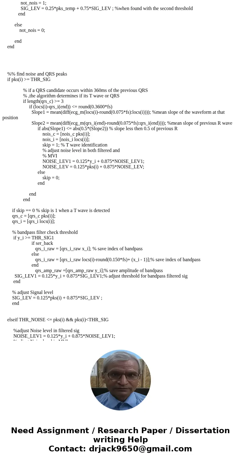 I need help understanding the Pan Tompkins algorythm, and I\'d also like to know how to detect QRS peaks of the ECG (with circles, for example). I\'m using the  I need help understanding the Pan Tompkins algorythm, and I\'d also like to know how to detect QRS peaks of the ECG (with circles, for example). I\'m using the