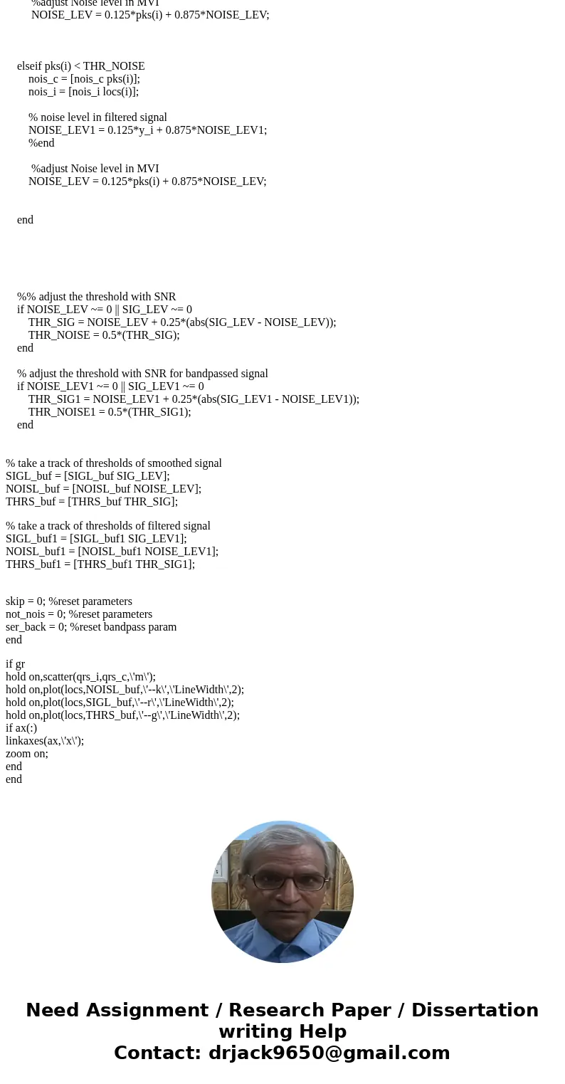 I need help understanding the Pan Tompkins algorythm, and I\'d also like to know how to detect QRS peaks of the ECG (with circles, for example). I\'m using the  I need help understanding the Pan Tompkins algorythm, and I\'d also like to know how to detect QRS peaks of the ECG (with circles, for example). I\'m using the