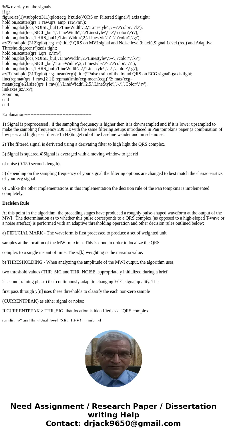 I need help understanding the Pan Tompkins algorythm, and I\'d also like to know how to detect QRS peaks of the ECG (with circles, for example). I\'m using the  I need help understanding the Pan Tompkins algorythm, and I\'d also like to know how to detect QRS peaks of the ECG (with circles, for example). I\'m using the