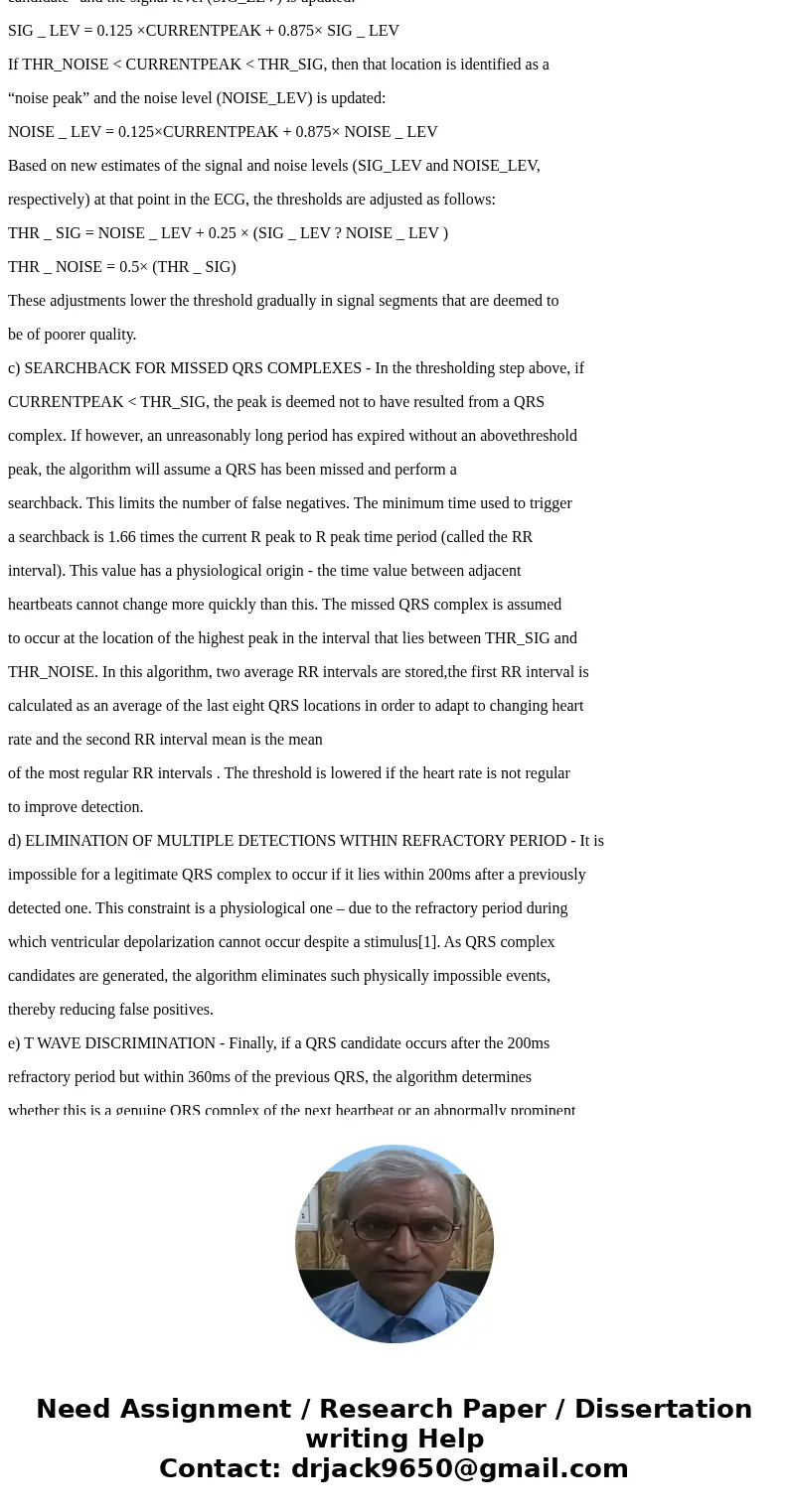 I need help understanding the Pan Tompkins algorythm, and I\'d also like to know how to detect QRS peaks of the ECG (with circles, for example). I\'m using the  I need help understanding the Pan Tompkins algorythm, and I\'d also like to know how to detect QRS peaks of the ECG (with circles, for example). I\'m using the