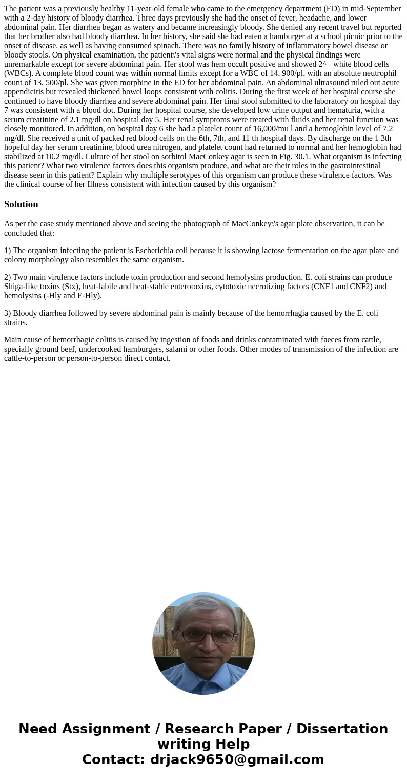  The patient was a previously healthy 11-year-old female who came to the emergency department (ED) in mid-September with a 2-day history of bloody diarrhea. Thr