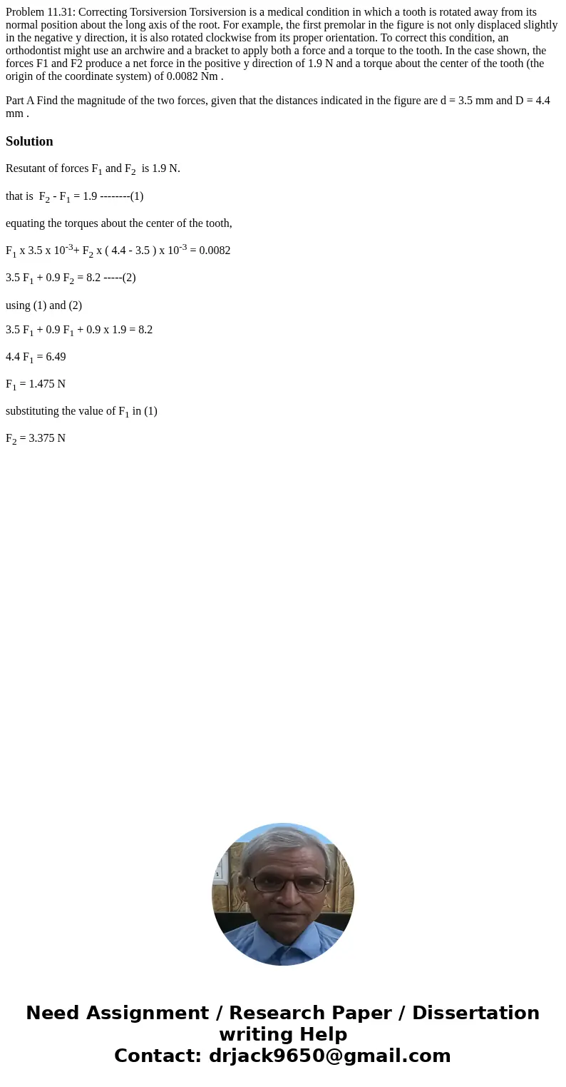 Problem 11.31: Correcting Torsiversion Torsiversion is a medical condition in which a tooth is rotated away from its normal position about the long axis of the 