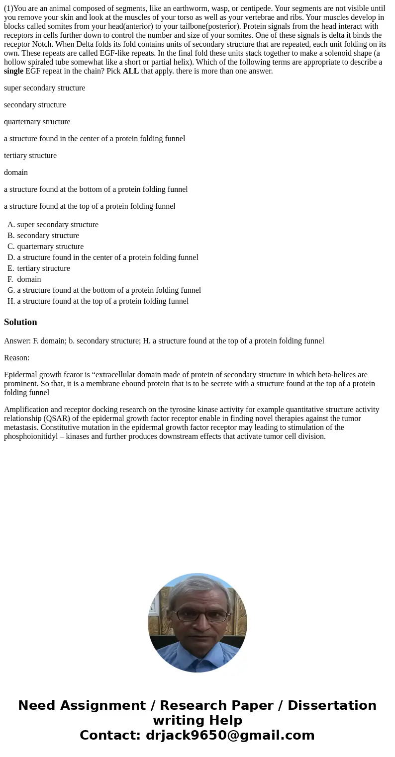 (1)You are an animal composed of segments, like an earthworm, wasp, or centipede. Your segments are not visible until you remove your skin and look at the muscl (1)You are an animal composed of segments, like an earthworm, wasp, or centipede. Your segments are not visible until you remove your skin and look at the muscl
