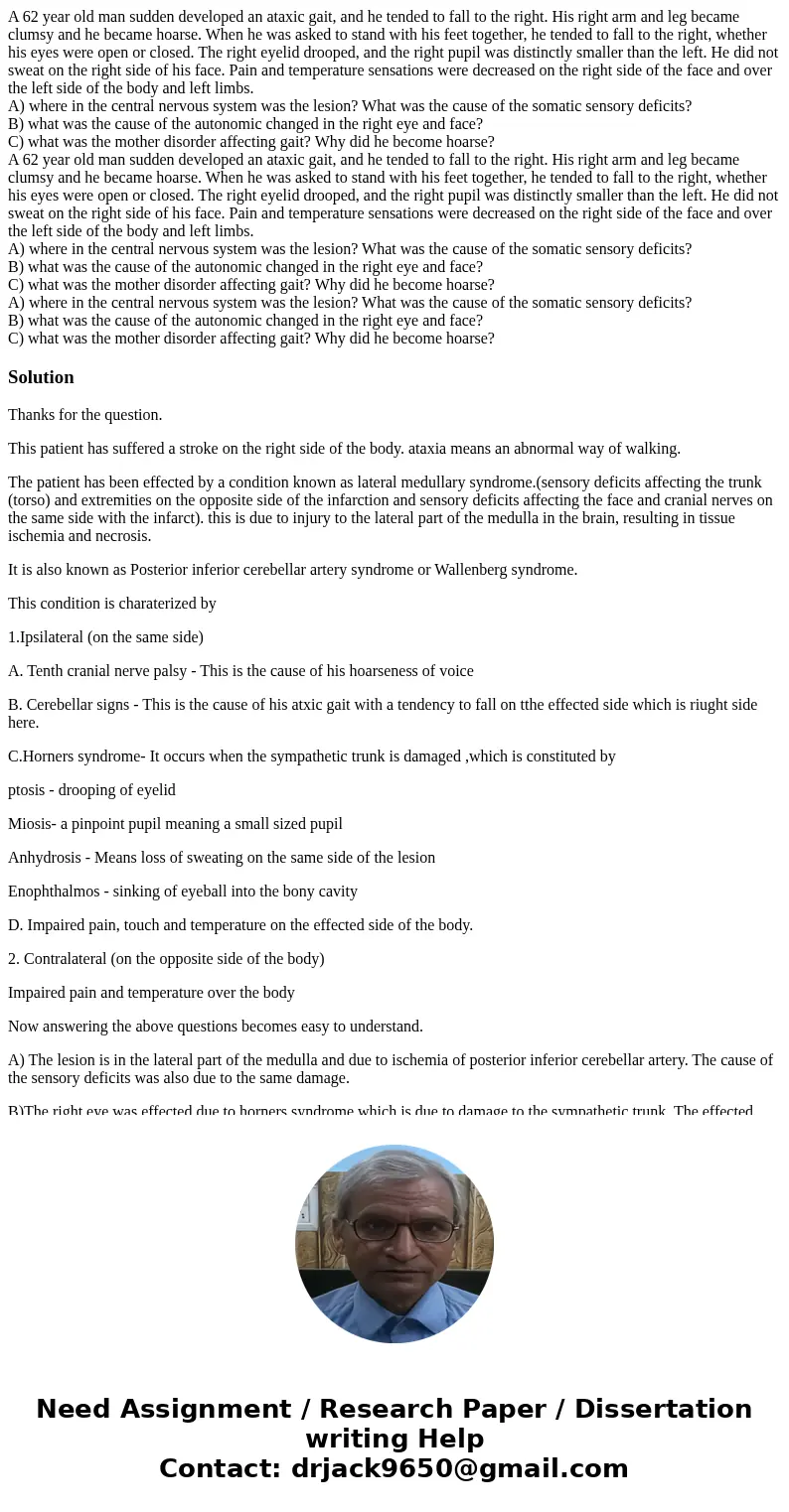 A 62 year old man sudden developed an ataxic gait, and he tended to fall to the right. His right arm and leg became clumsy and he became hoarse. When he was ask A 62 year old man sudden developed an ataxic gait, and he tended to fall to the right. His right arm and leg became clumsy and he became hoarse. When he was ask