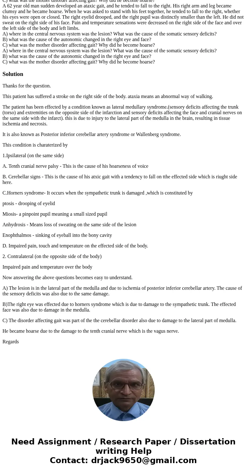 A 62 year old man sudden developed an ataxic gait, and he tended to fall to the right. His right arm and leg became clumsy and he became hoarse. When he was ask A 62 year old man sudden developed an ataxic gait, and he tended to fall to the right. His right arm and leg became clumsy and he became hoarse. When he was ask