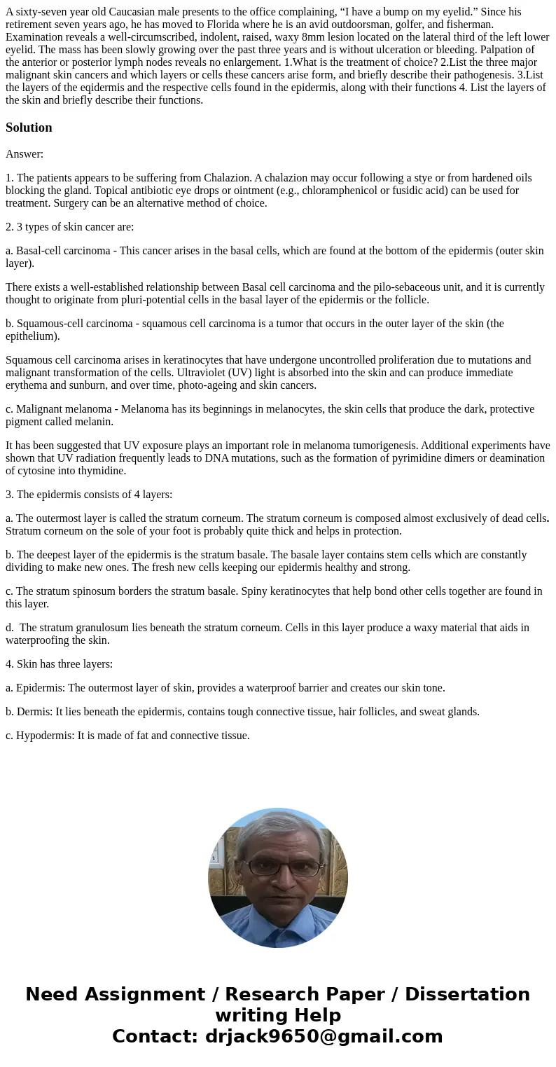 A sixty-seven year old Caucasian male presents to the office complaining, “I have a bump on my eyelid.” Since his retirement seven years ago, he has moved to Fl
