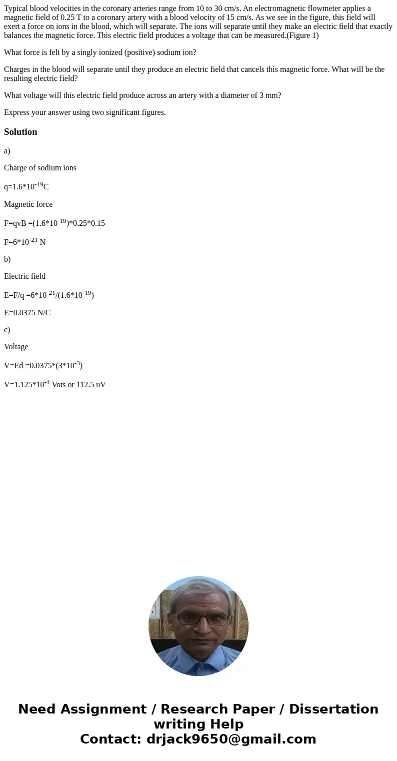 Typical blood velocities in the coronary arteries range from 10 to 30 cm/s. An electromagnetic flowmeter applies a magnetic field of 0.25 T to a coronary artery Typical blood velocities in the coronary arteries range from 10 to 30 cm/s. An electromagnetic flowmeter applies a magnetic field of 0.25 T to a coronary artery