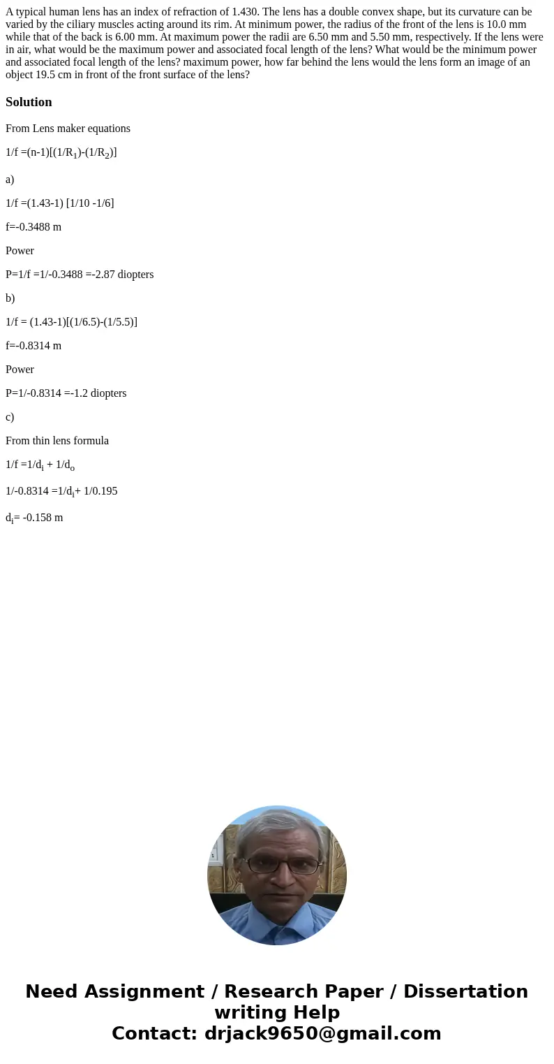 A typical human lens has an index of refraction of 1.430. The lens has a double convex shape, but its curvature can be varied by the ciliary muscles acting aro  A typical human lens has an index of refraction of 1.430. The lens has a double convex shape, but its curvature can be varied by the ciliary muscles acting aro
