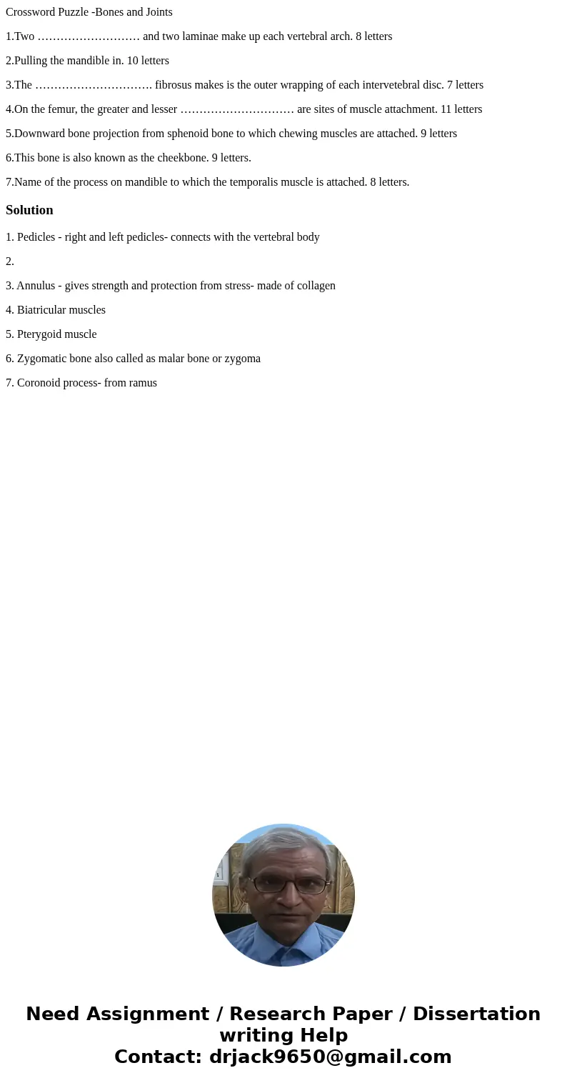 Crossword Puzzle -Bones and Joints 1.Two ……………………… and two laminae make up each vertebral arch. 8 letters 2.Pulling the mandible in. 10 letters 3.The ………………………… Crossword Puzzle -Bones and Joints 1.Two ……………………… and two laminae make up each vertebral arch. 8 letters 2.Pulling the mandible in. 10 letters 3.The …………………………