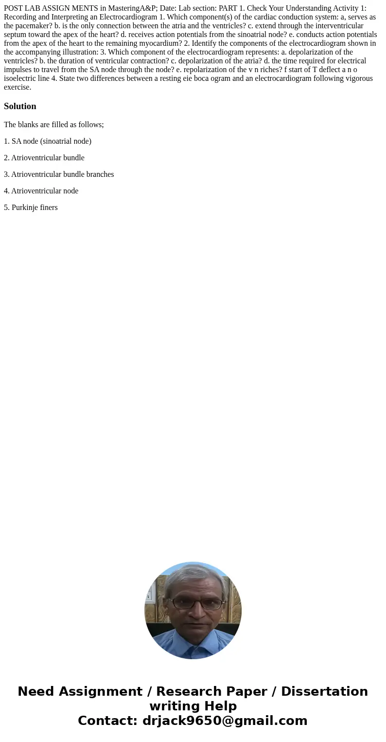 POST LAB ASSIGN MENTS in MasteringA&P; Date: Lab section: PART 1. Check Your Understanding Activity 1: Recording and Interpreting an Electrocardiogram 1. W  POST LAB ASSIGN MENTS in MasteringA&P; Date: Lab section: PART 1. Check Your Understanding Activity 1: Recording and Interpreting an Electrocardiogram 1. W