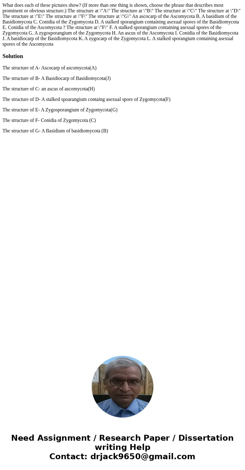 What does each of these pictures show? (If more than one thing is shown, choose the phrase that describes most prominent or obvious structure.) The structure a  What does each of these pictures show? (If more than one thing is shown, choose the phrase that describes most prominent or obvious structure.) The structure a