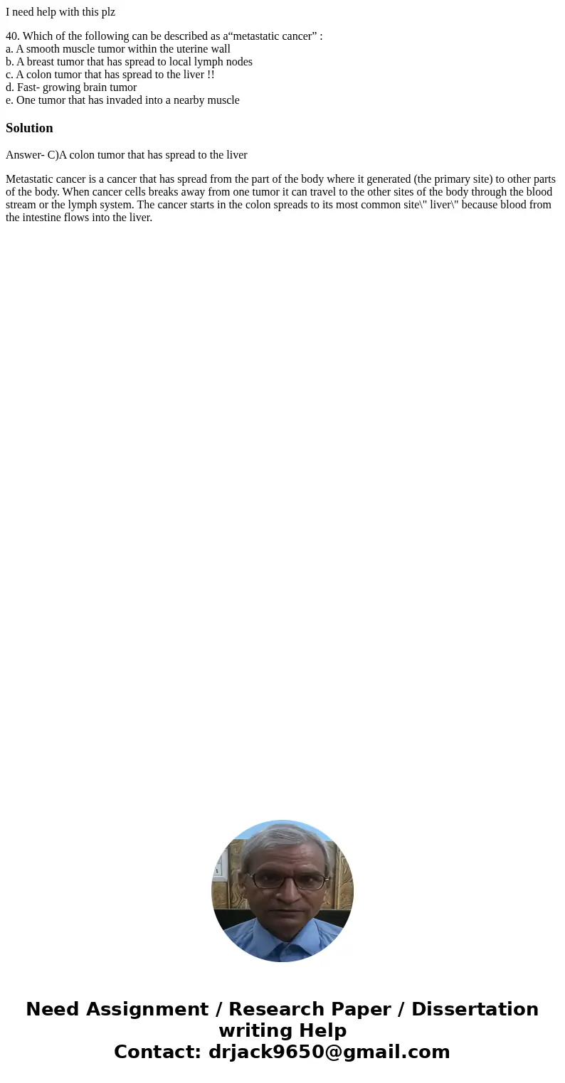 I need help with this plz 40. Which of the following can be described as a“metastatic cancer” : a. A smooth muscle tumor within the uterine wall b. A breast tum