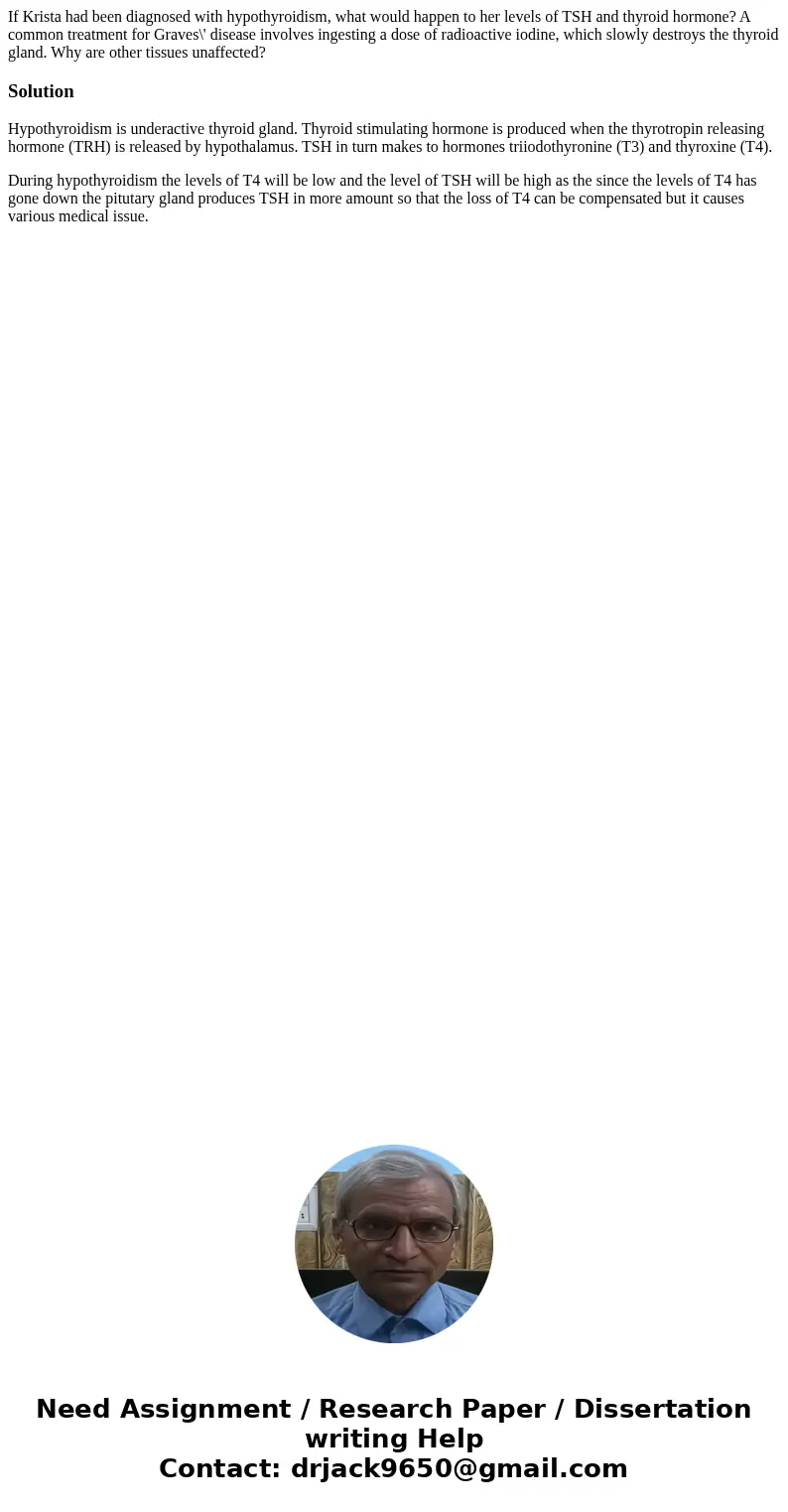 If Krista had been diagnosed with hypothyroidism, what would happen to her levels of TSH and thyroid hormone? A common treatment for Graves\' disease involves   If Krista had been diagnosed with hypothyroidism, what would happen to her levels of TSH and thyroid hormone? A common treatment for Graves\' disease involves