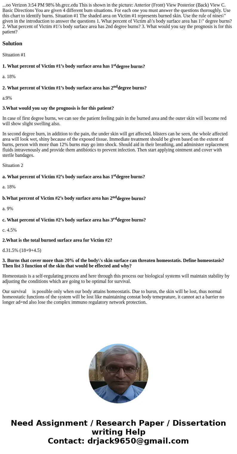 ...oo Verizon 3:54 PM 98% bb.grcc.edu This is shown in the picture: Anterior (Front) View Posterior (Back) View C. Basic Directions You are given 4 different b  ...oo Verizon 3:54 PM 98% bb.grcc.edu This is shown in the picture: Anterior (Front) View Posterior (Back) View C. Basic Directions You are given 4 different b