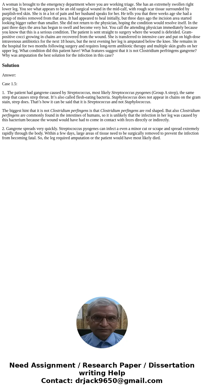  A woman is brought to the emergency department where you are working triage. She has an extremely swollen right lower leg. You see what appears to be an old su
