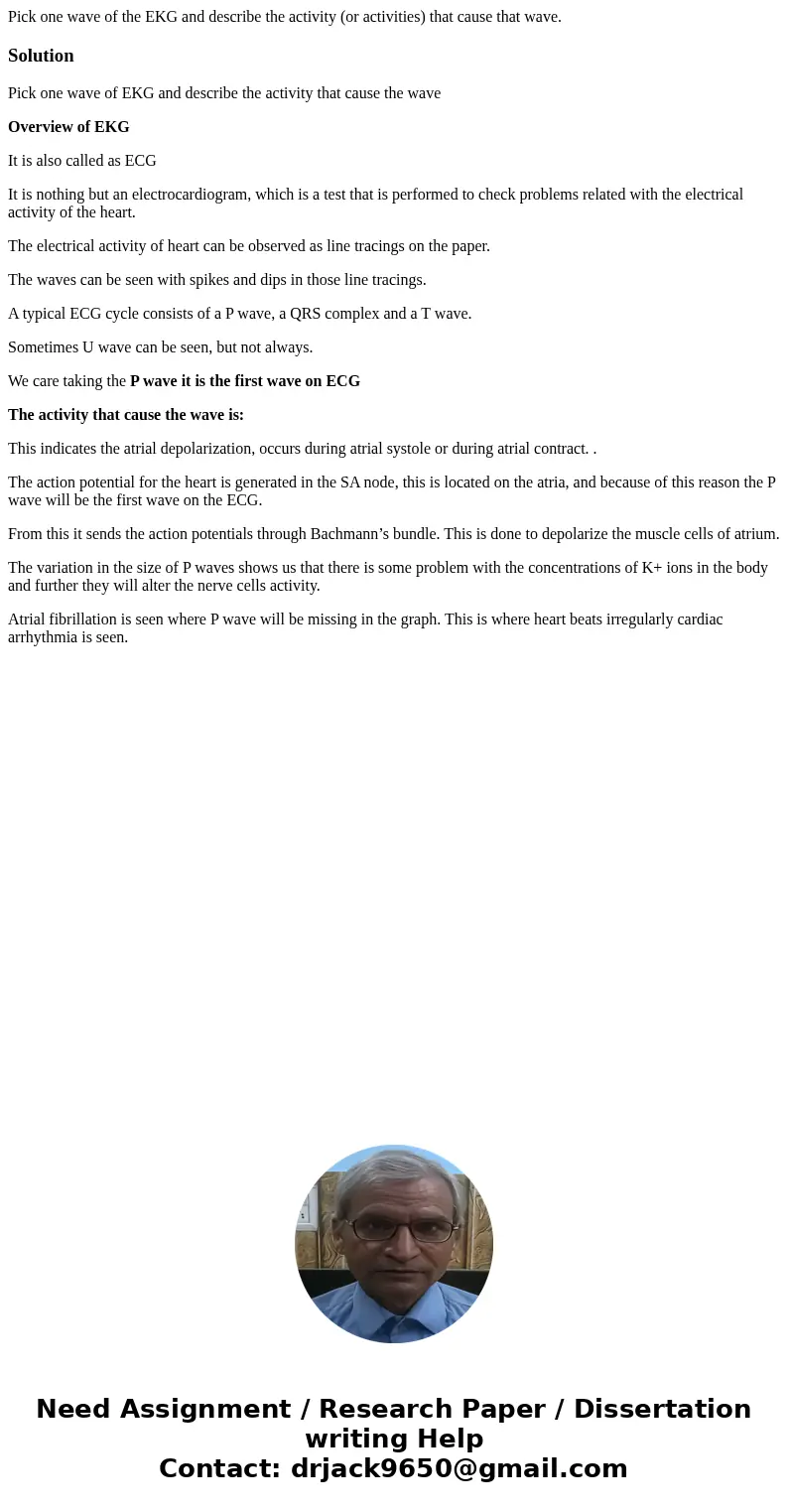  Pick one wave of the EKG and describe the activity (or activities) that cause that wave.SolutionPick one wave of EKG and describe the activity that cause the w