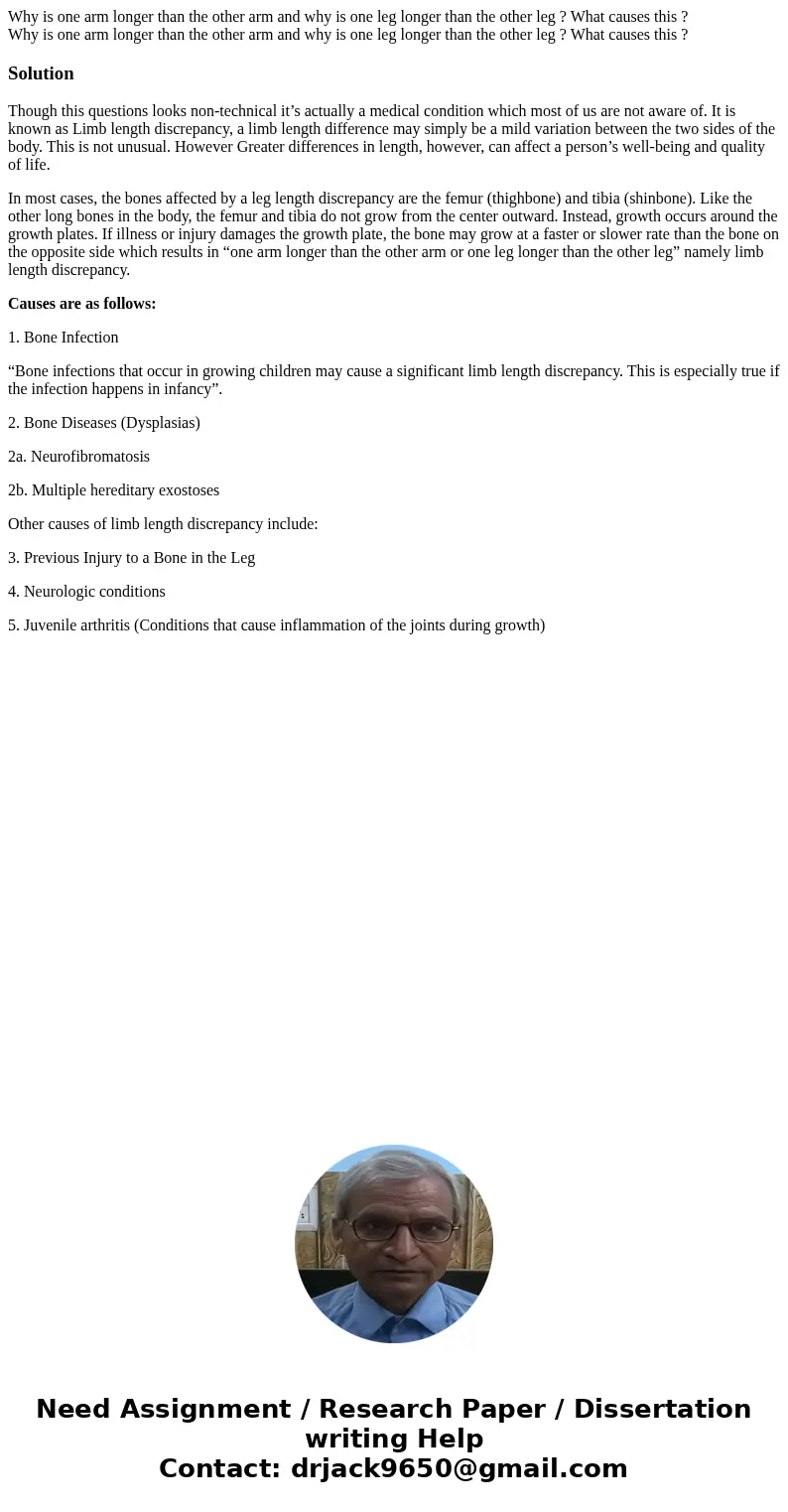 Why is one arm longer than the other arm and why is one leg longer than the other leg ? What causes this ? Why is one arm longer than the other arm and why is o Why is one arm longer than the other arm and why is one leg longer than the other leg ? What causes this ? Why is one arm longer than the other arm and why is o