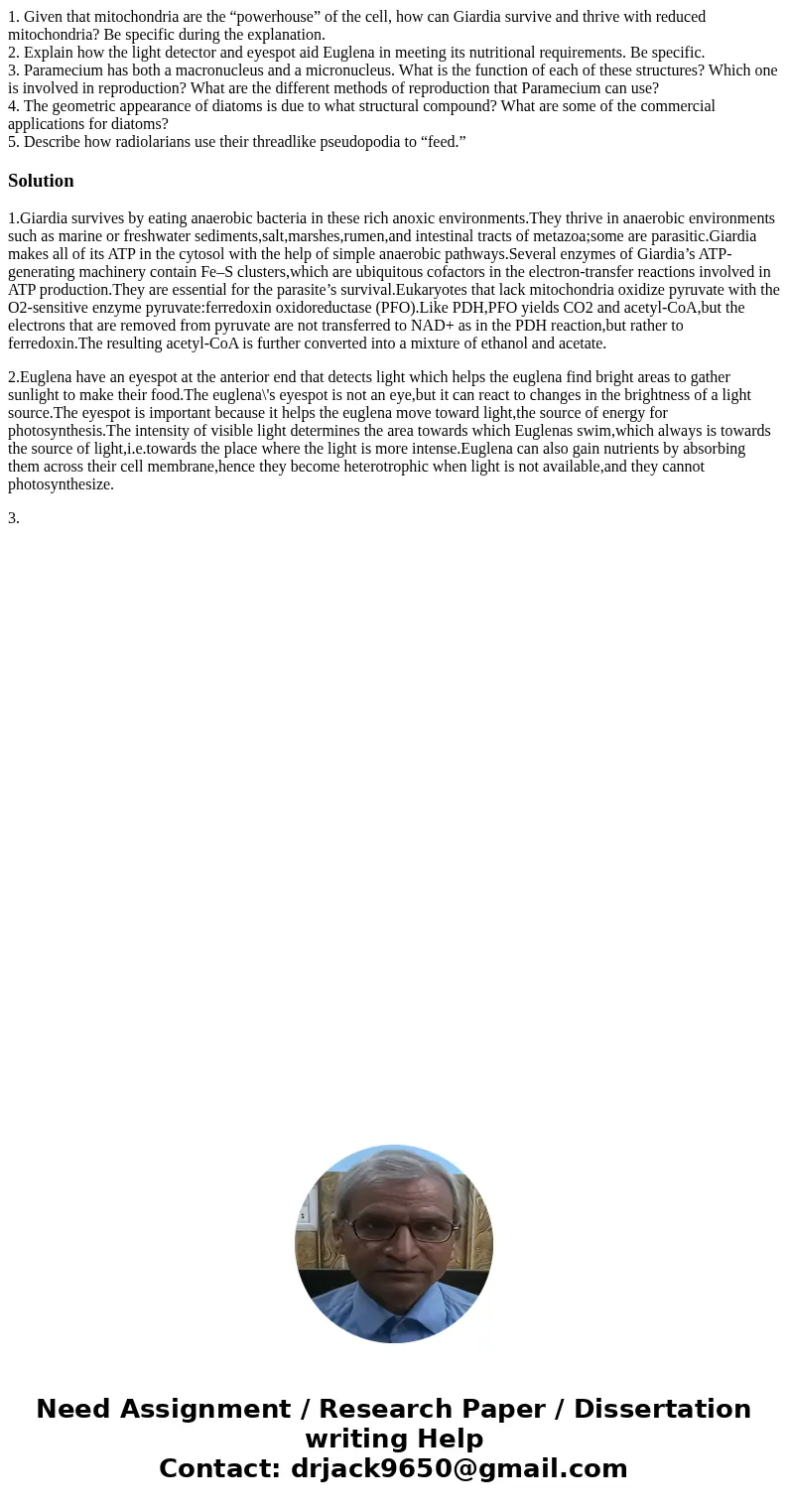 1. Given that mitochondria are the “powerhouse” of the cell, how can Giardia survive and thrive with reduced mitochondria? Be specific during the explanation. 2 1. Given that mitochondria are the “powerhouse” of the cell, how can Giardia survive and thrive with reduced mitochondria? Be specific during the explanation. 2