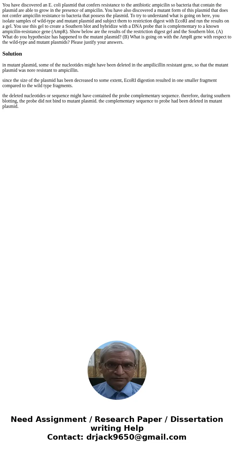 You have discovered an E. coli plasmid that confers resistance to the antibiotic ampicilin so bacteria that contain the plasmid are able to grow in the presenc  You have discovered an E. coli plasmid that confers resistance to the antibiotic ampicilin so bacteria that contain the plasmid are able to grow in the presenc