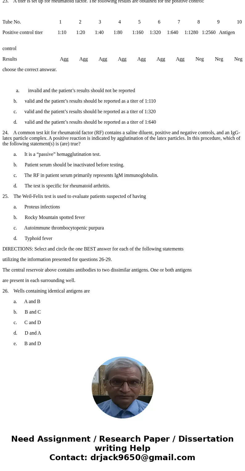 1. In humans, what organ is considered responsible for: a. supplying other lymphoid tissues with “uncommitted lymphocytes” b. producing lymphocyte-stimulating h 1. In humans, what organ is considered responsible for: a. supplying other lymphoid tissues with “uncommitted lymphocytes” b. producing lymphocyte-stimulating h