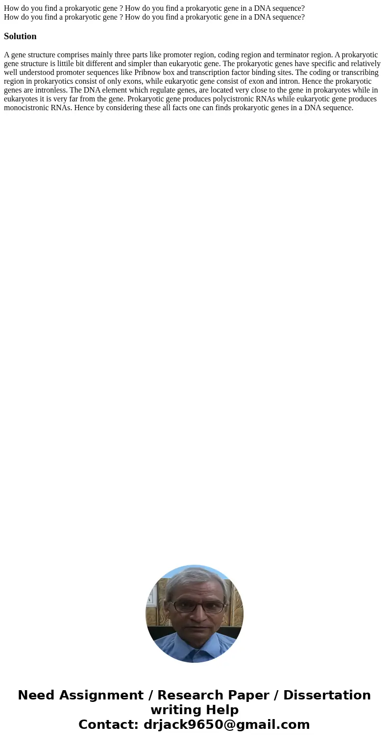 How do you find a prokaryotic gene ? How do you find a prokaryotic gene in a DNA sequence? How do you find a prokaryotic gene ? How do you find a prokaryotic ge How do you find a prokaryotic gene ? How do you find a prokaryotic gene in a DNA sequence? How do you find a prokaryotic gene ? How do you find a prokaryotic ge
