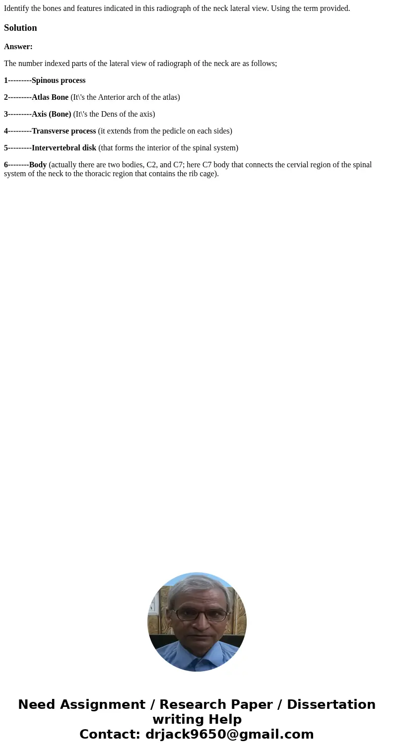 Identify the bones and features indicated in this radiograph of the neck lateral view. Using the term provided. SolutionAnswer: The number indexed parts of the  Identify the bones and features indicated in this radiograph of the neck lateral view. Using the term provided. SolutionAnswer: The number indexed parts of the