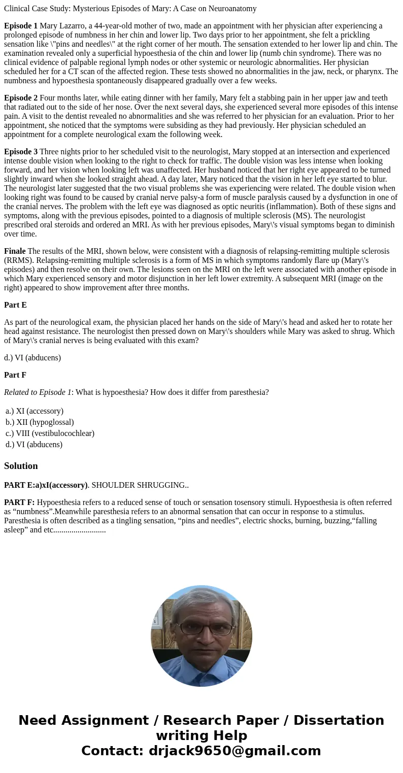 Clinical Case Study: Mysterious Episodes of Mary: A Case on Neuroanatomy Episode 1 Mary Lazarro, a 44-year-old mother of two, made an appointment with her physi Clinical Case Study: Mysterious Episodes of Mary: A Case on Neuroanatomy Episode 1 Mary Lazarro, a 44-year-old mother of two, made an appointment with her physi