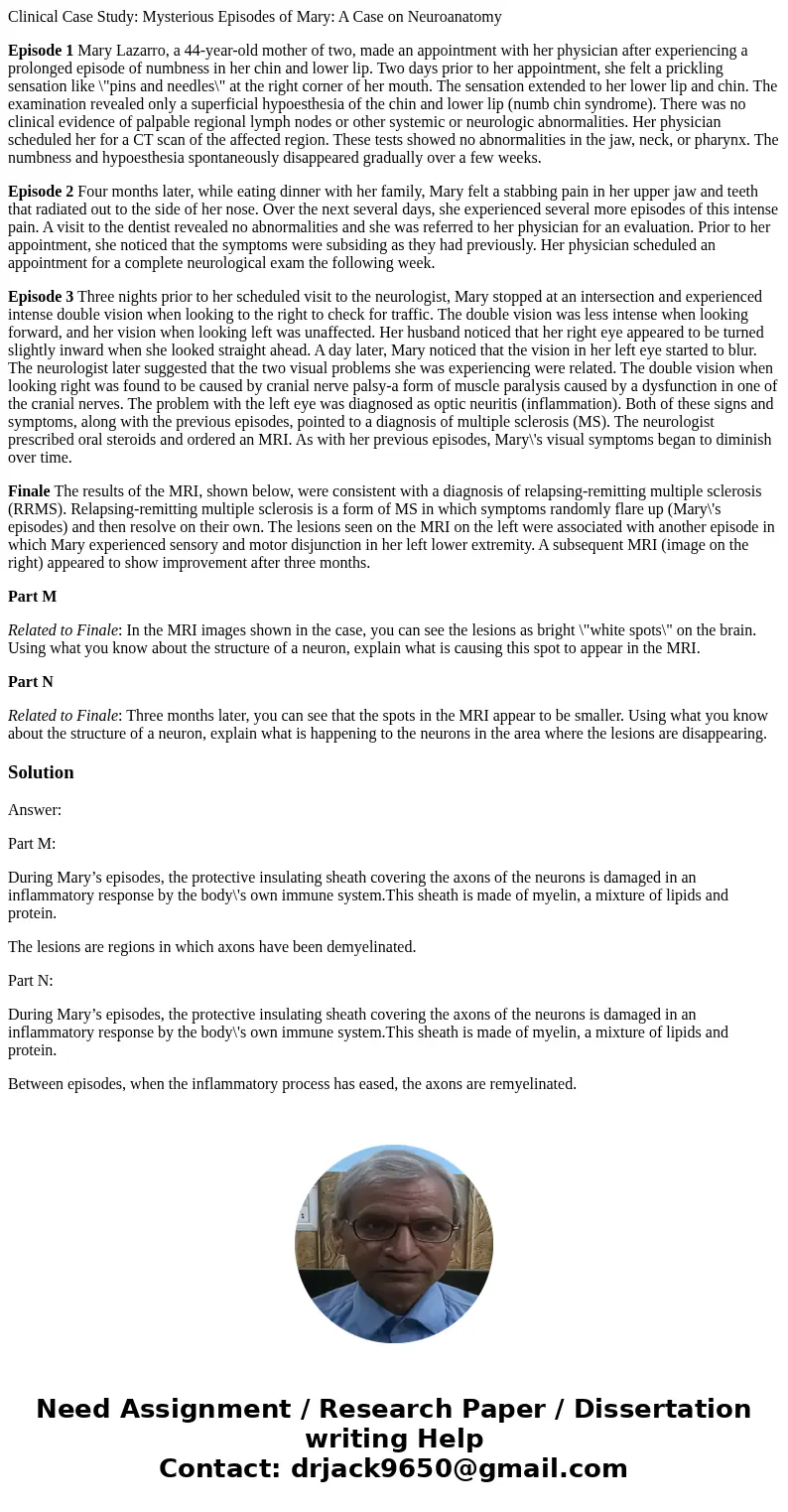 Clinical Case Study: Mysterious Episodes of Mary: A Case on Neuroanatomy Episode 1 Mary Lazarro, a 44-year-old mother of two, made an appointment with her physi Clinical Case Study: Mysterious Episodes of Mary: A Case on Neuroanatomy Episode 1 Mary Lazarro, a 44-year-old mother of two, made an appointment with her physi