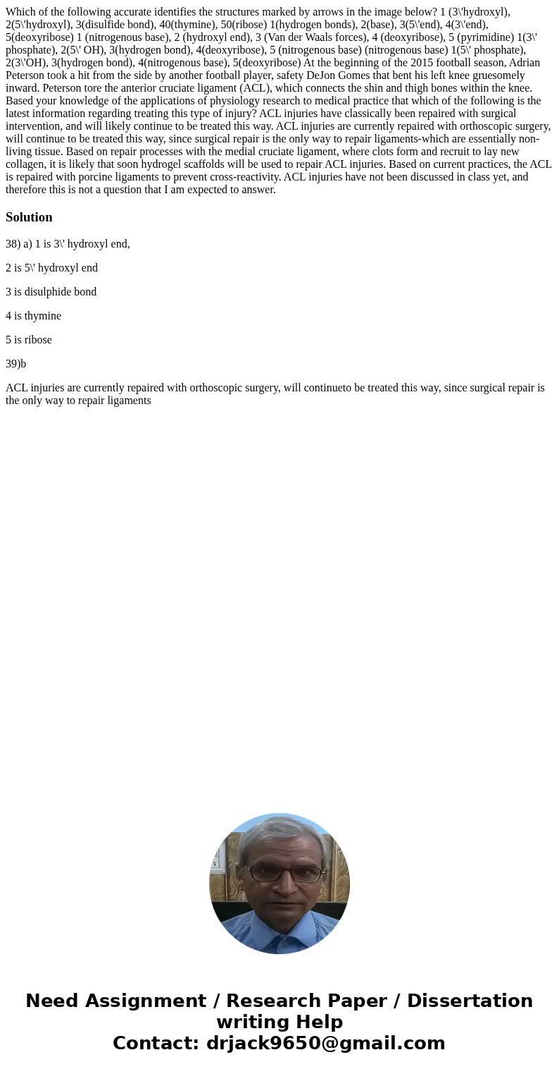  Which of the following accurate identifies the structures marked by arrows in the image below? 1 (3\'hydroxyl), 2(5\'hydroxyl), 3(disulfide bond), 40(thymine),