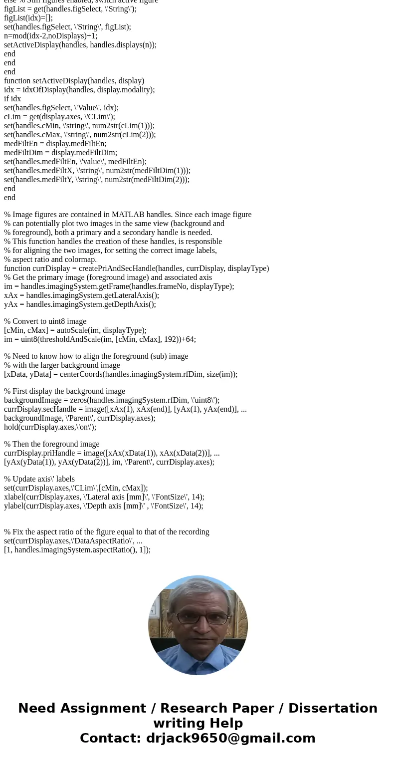 write a MATLAB GUI program that implements an ultrasound image viewing and manipulation program. Your program must have the following features: (a) Load and dis write a MATLAB GUI program that implements an ultrasound image viewing and manipulation program. Your program must have the following features: (a) Load and dis