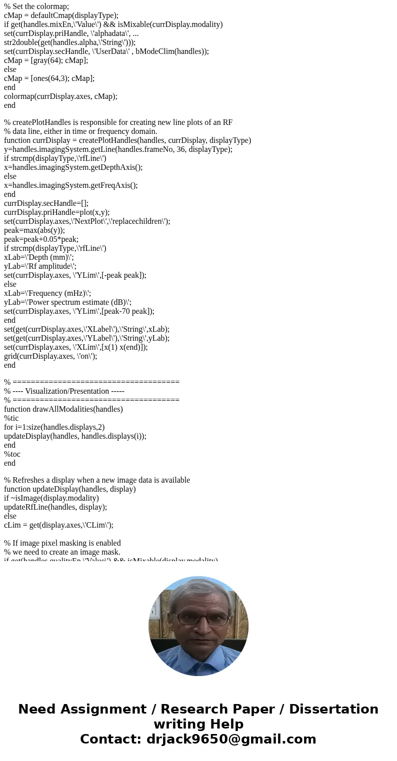 write a MATLAB GUI program that implements an ultrasound image viewing and manipulation program. Your program must have the following features: (a) Load and dis write a MATLAB GUI program that implements an ultrasound image viewing and manipulation program. Your program must have the following features: (a) Load and dis