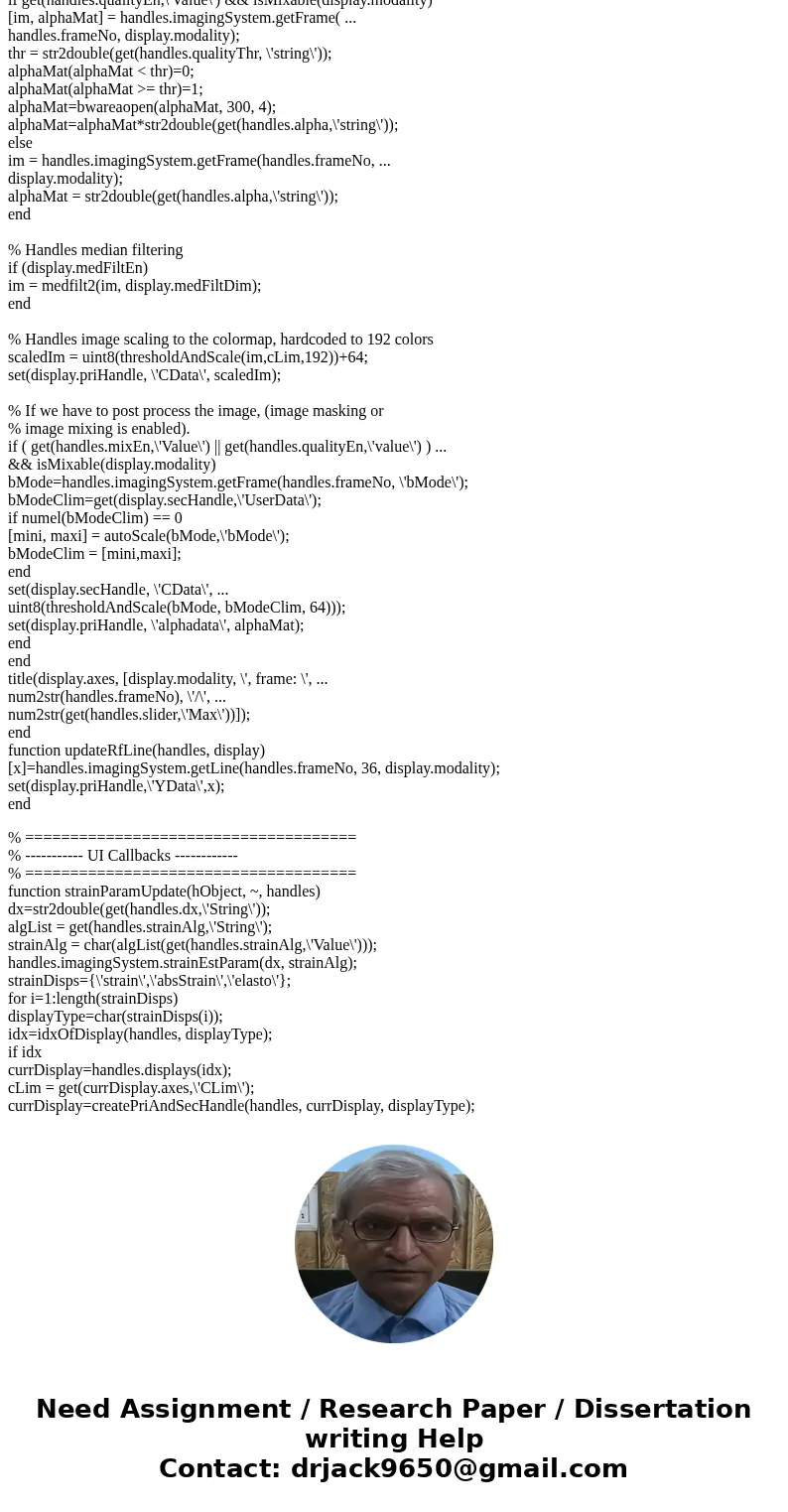 write a MATLAB GUI program that implements an ultrasound image viewing and manipulation program. Your program must have the following features: (a) Load and dis write a MATLAB GUI program that implements an ultrasound image viewing and manipulation program. Your program must have the following features: (a) Load and dis
