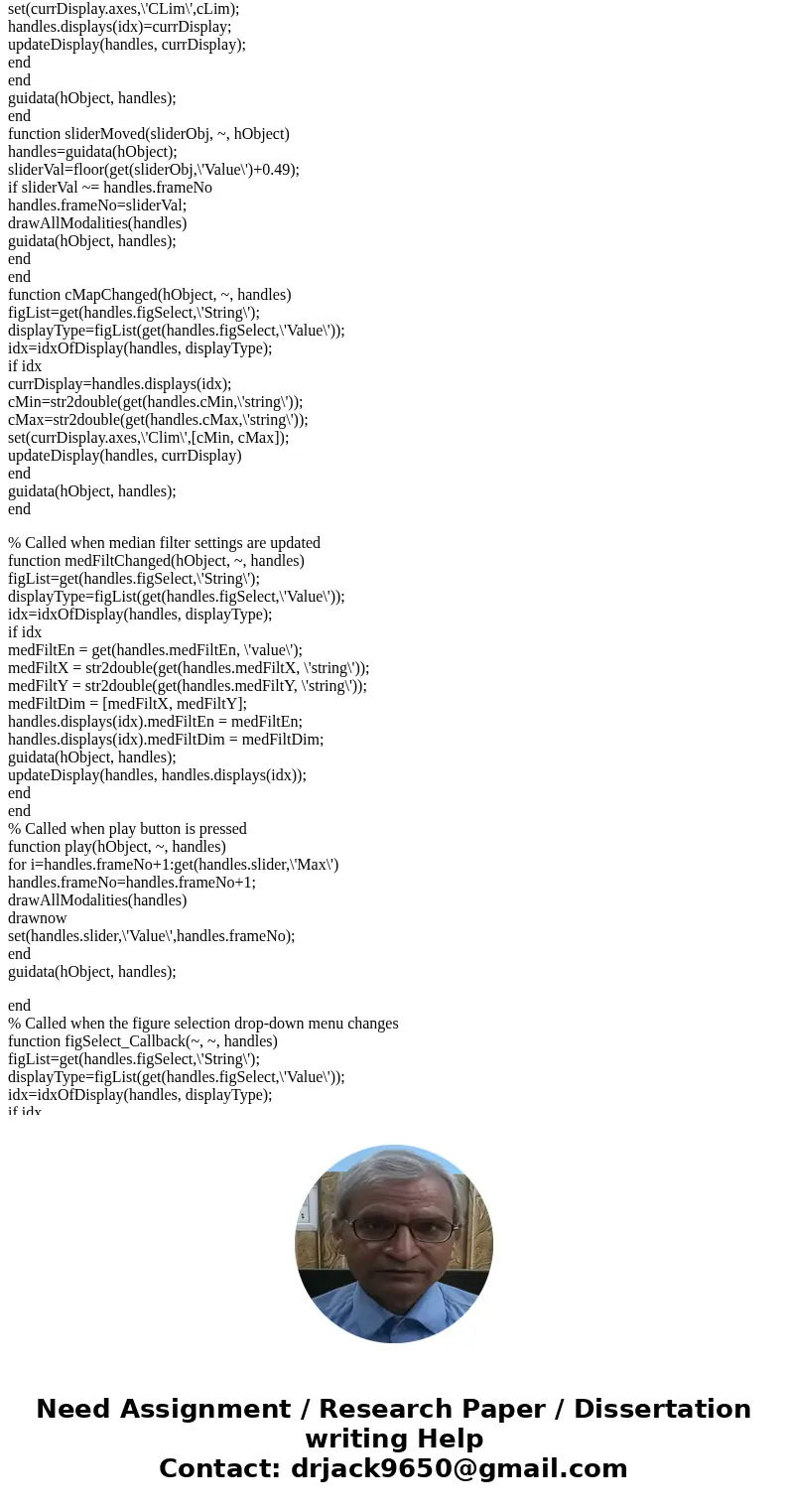 write a MATLAB GUI program that implements an ultrasound image viewing and manipulation program. Your program must have the following features: (a) Load and dis write a MATLAB GUI program that implements an ultrasound image viewing and manipulation program. Your program must have the following features: (a) Load and dis